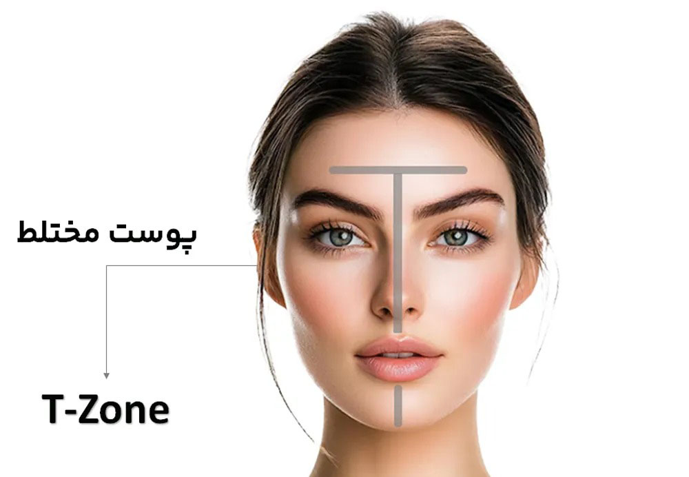 پوست مختلط + ارایشی مسی