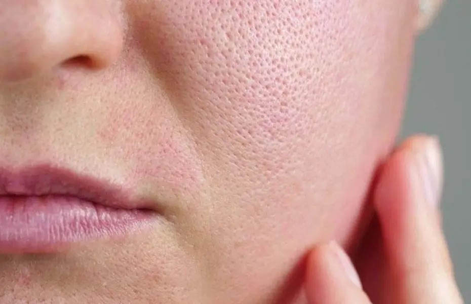 پوست حساس + ارایشی مسی
