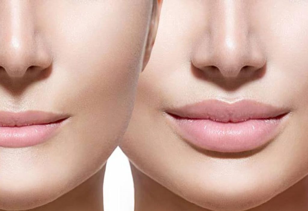 حجم‌ دهنده لب + ارایشی مسی